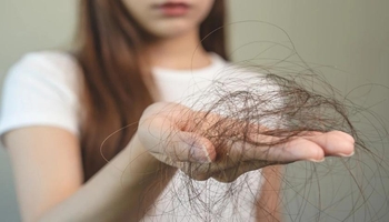 چارەسەری هەڵوەرینی قژ بە خۆراک لە زانستی پزیشکی کۆن