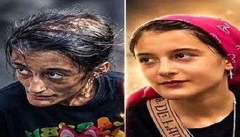 پایان کابوس «نارین»؛ وقتی همدلی مردم و تلاش پزشکان، زندگی را دوباره به یک کودک برگرداند