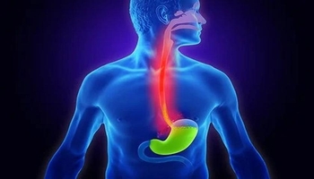 کۆنتڕۆڵی ترشی گەدە بە خواردنی ئەم خوراکانە