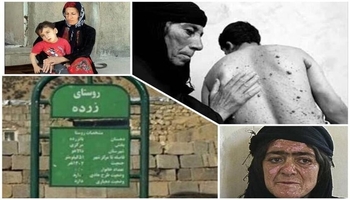 خەردەڵ لە سییەکان، برین لە یادەوەرییەکان؛ گێڕانەوەی ژیانی خەڵکی زەردە لە ژێر سێبەری مەرگی کیمیاییدا